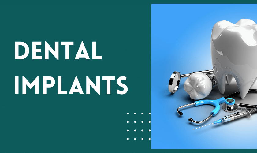 dental implants in Texas