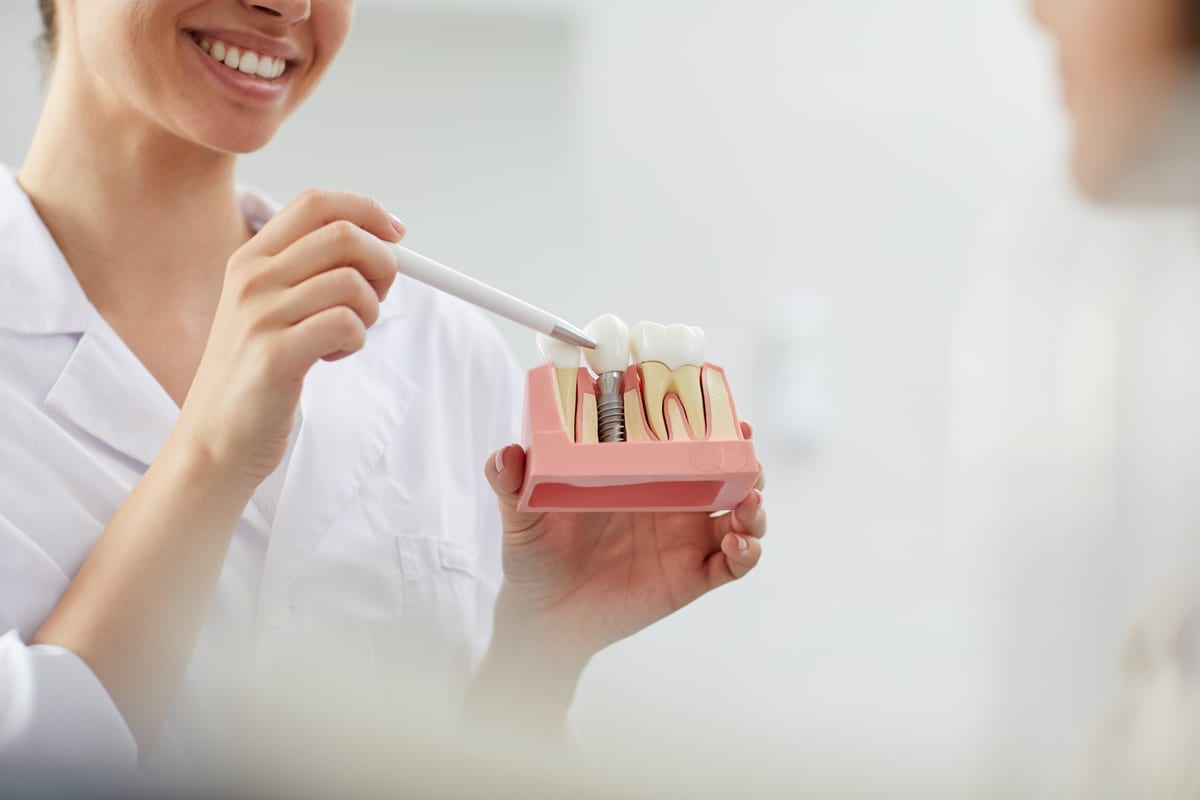 Dental Implants in Conroe