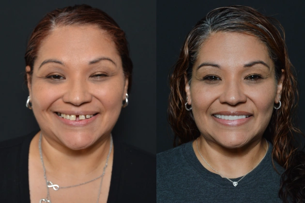 Tammy's Smile
